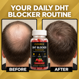 Natural DHT Blocker