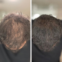<h2>Thousands of men have reclaimed their confidence</h2>