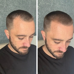 <h2>Thousands of men have reclaimed their confidence</h2>