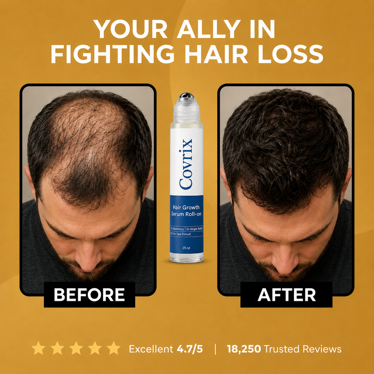 Hair Regrowth Serum