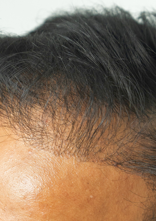 Before