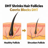 DHT-related hair follicle miniaturization illustration