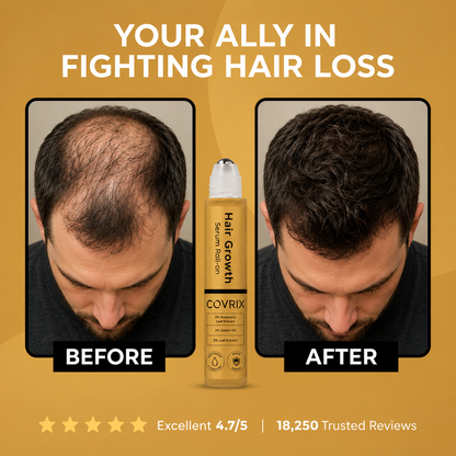 Hair Regrowth Serum